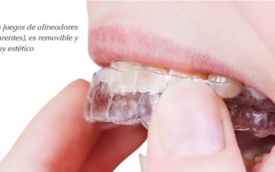 Invisalign: ¡descubre las ventajas de la ortodoncia invisible!