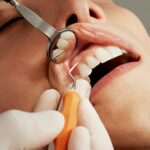 Periodoncia en Ciudad Lineal - Atauri & Cano